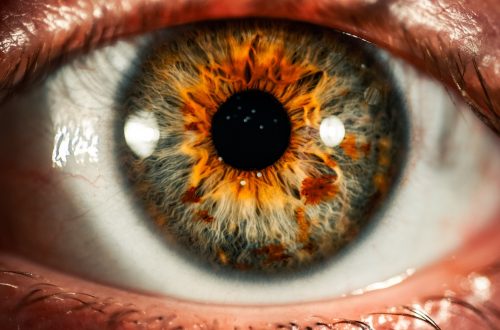 Что такое глаукома и как она проявляется