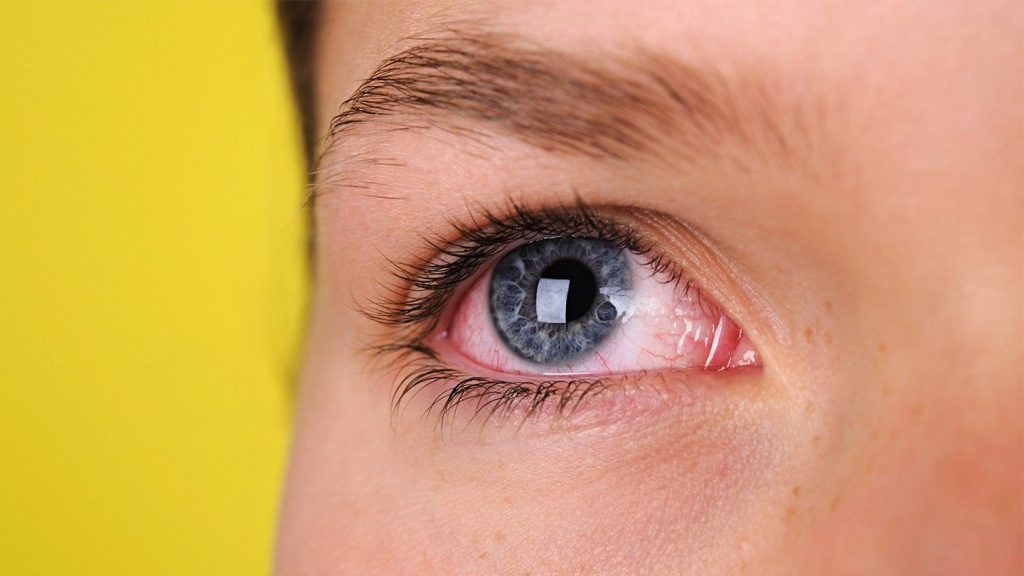 Что такое глаукома и как она проявляется